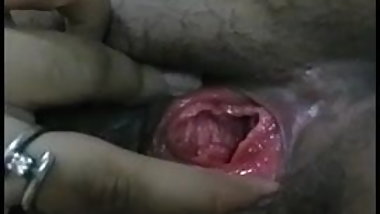 Oral